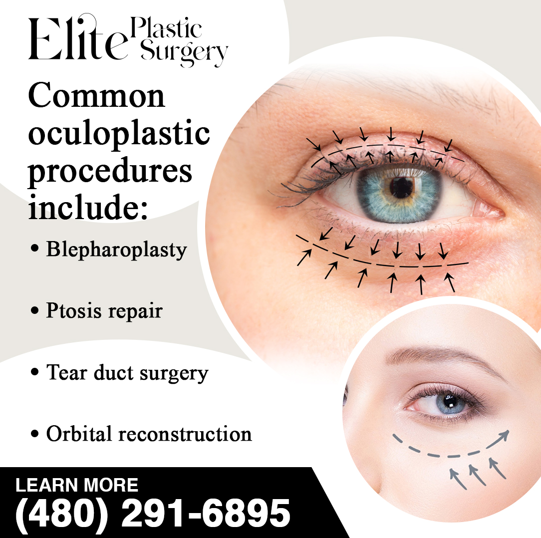 What Is Oculoplastic Surgery
